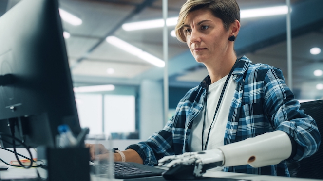 Very productive disabled employee with a mechanical arm reaching bottom lines at work at her desk